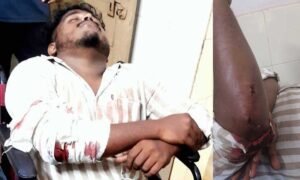 Bajpe-Akhilesh-Attack